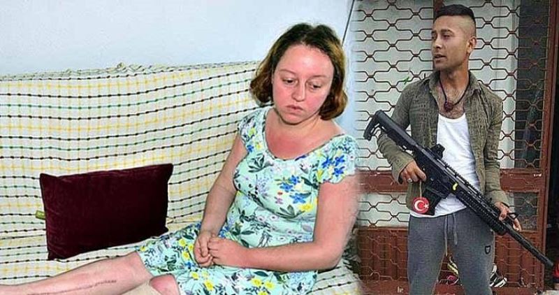 Eşini vurup bacağının kesilmesine neden olan eşe indirimsiz ceza