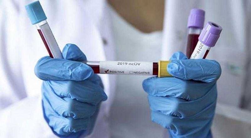Covid-19, kanser hastalarının 5’te 1’ini öldürüyor
